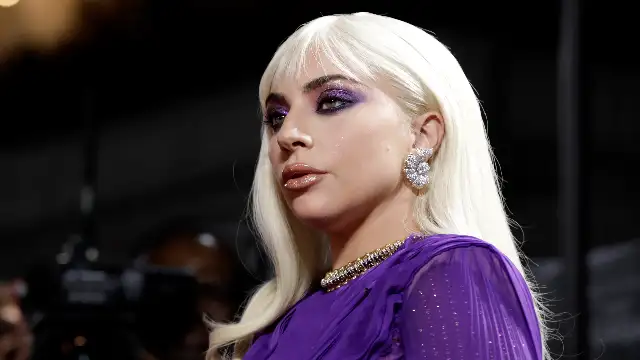 Lady Gaga Posts Tearful Apology