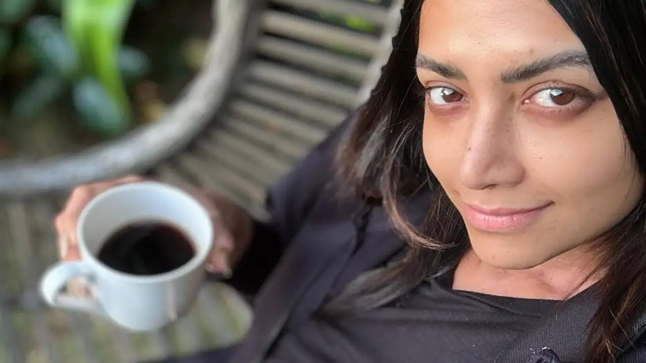 Mamata Mohandas diagnosed with Vitiligo after battling Cancer Mamata Mohandas diagnosed with Vitiligo