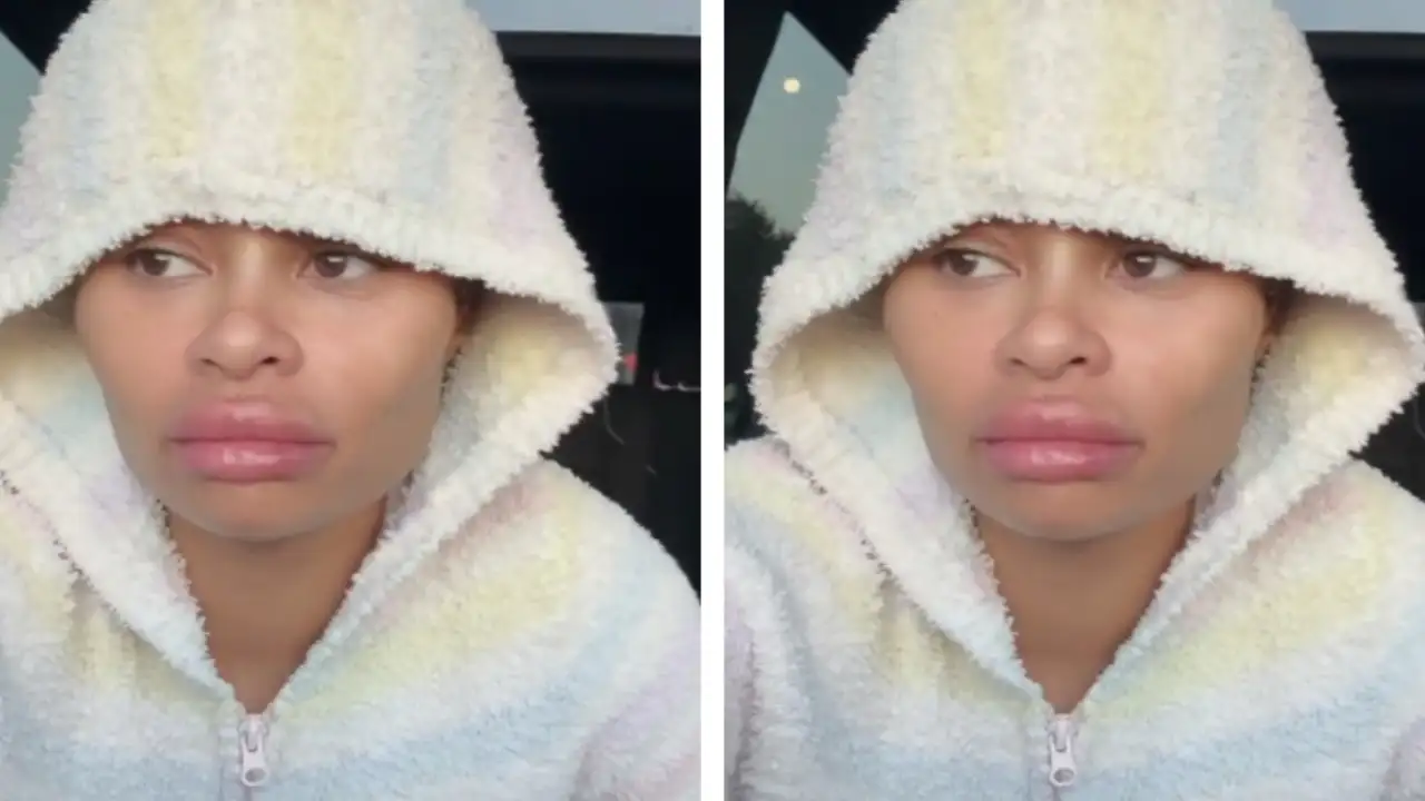 Blac Chyna removes facial fillers after butt and breast surgery, internal DEETS