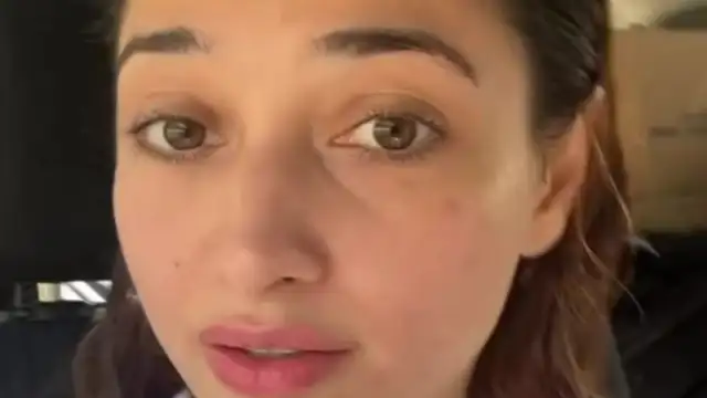 Tamannaah Bhatia shows off 'bad skin day' in unfiltered video and shares gentle reminder to love yourself Tamanna Bhatia shows off her 'bad skin day'