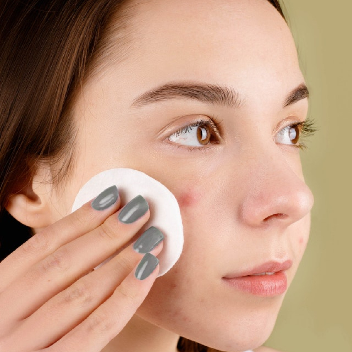 EXCLUSIVE: Expert approved tips on how to deal with acne during monsoons 