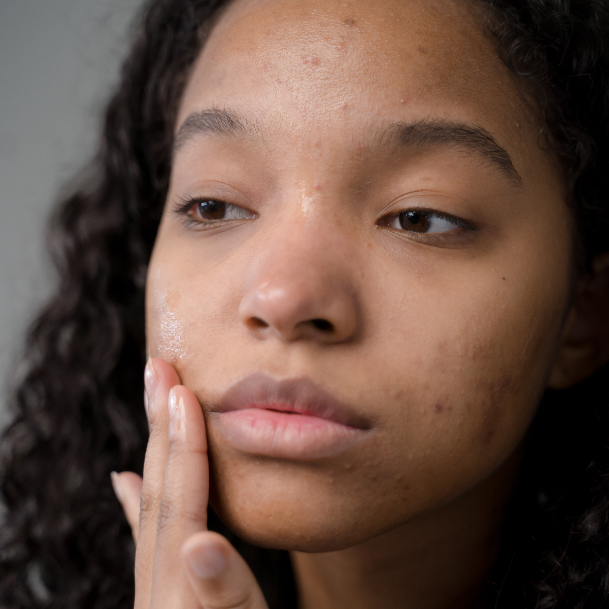 Face wash for pimples: 8 Anti-acne cleansers for all skin types to help you achieve clear skin