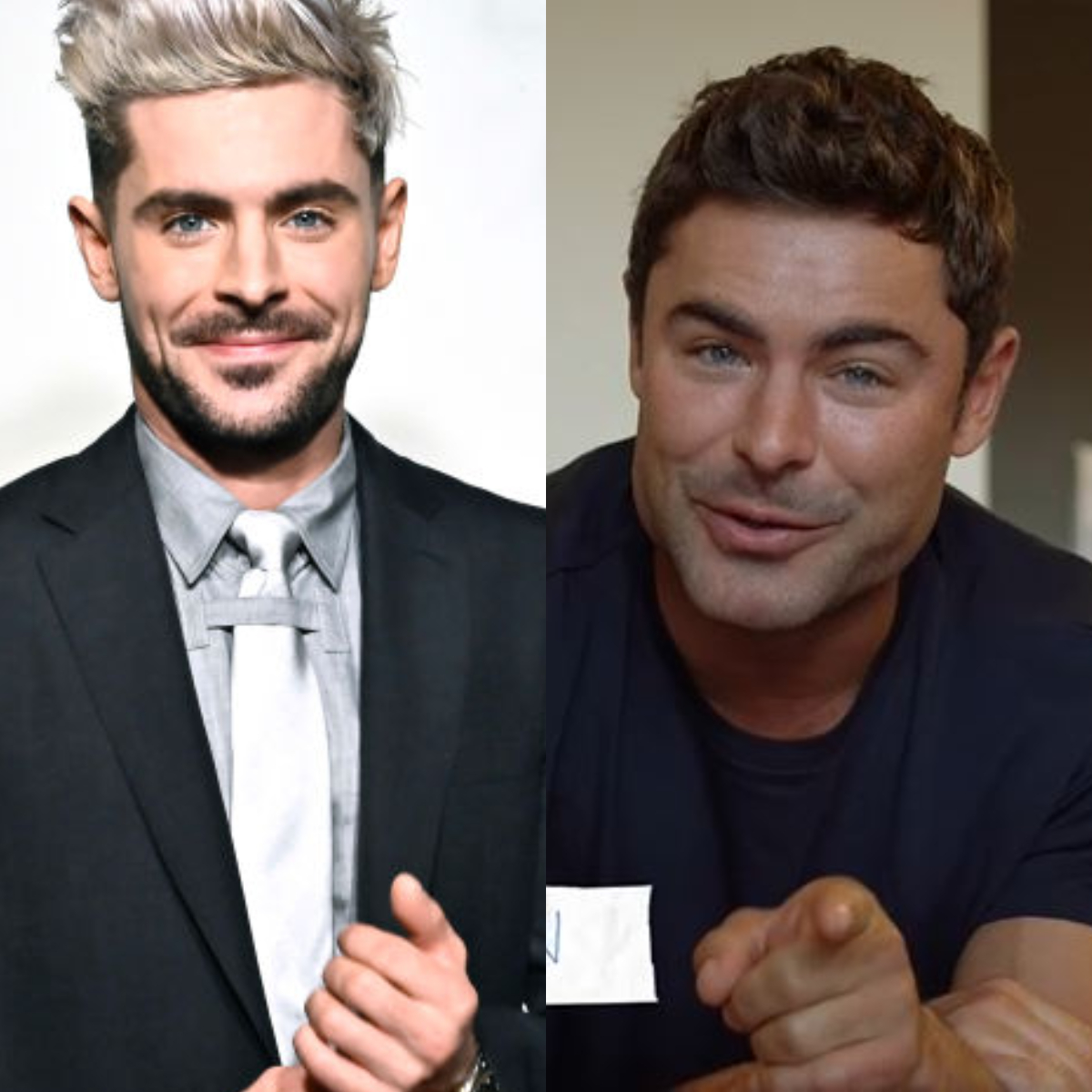 Операция заки. Зак Эфрон пластика лица. Зак Эфрон до и после пластики. Zac Efron after Plastic Surgery.