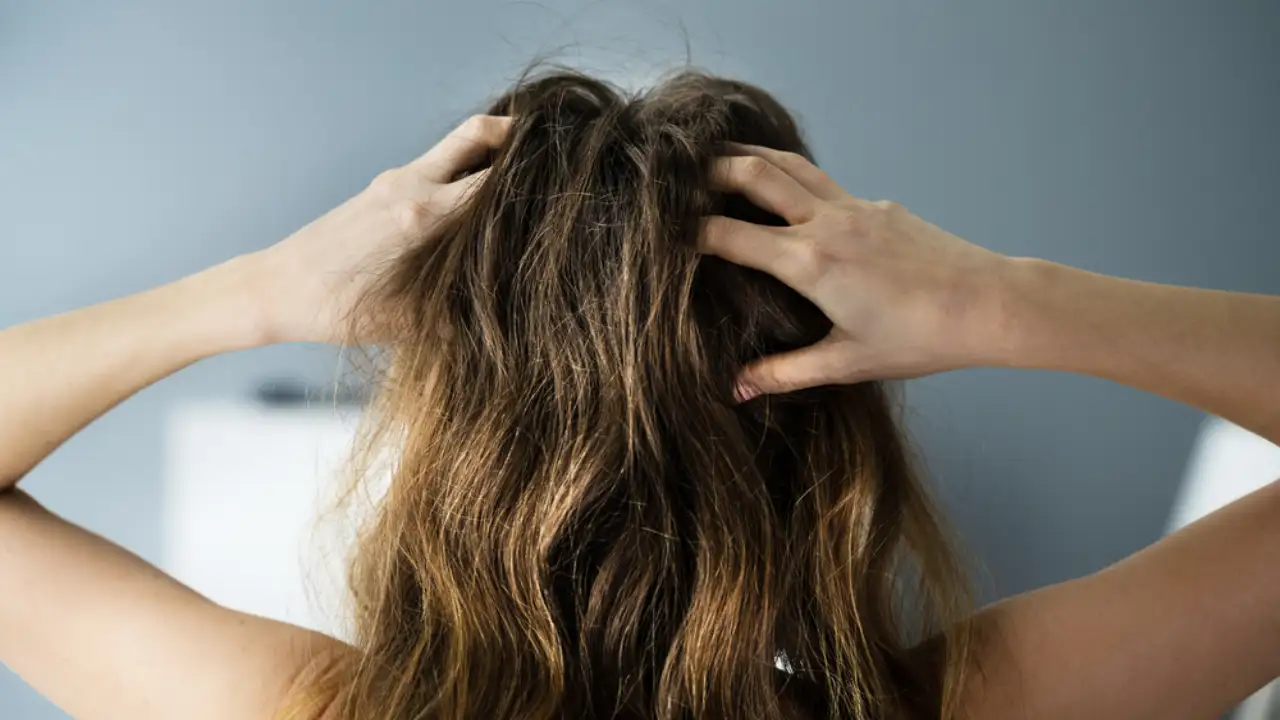 Some Easy and Natural DIY Home Remedies for Dry Scalp 