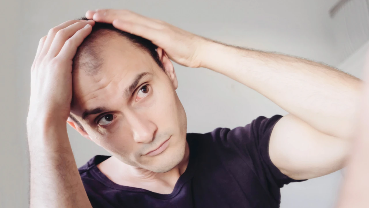 A Quick Guide to Fighting And Preventing Hair Loss On Temples 