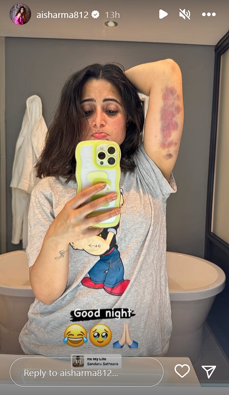 Aishwarya Sharma got injured on the sets of Khatron Ke Khiladi 13