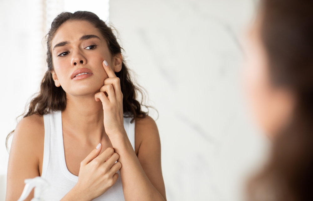 Cold Sore Vs. Pimple Key Differences, Treatment And Prevention PINKVILLA