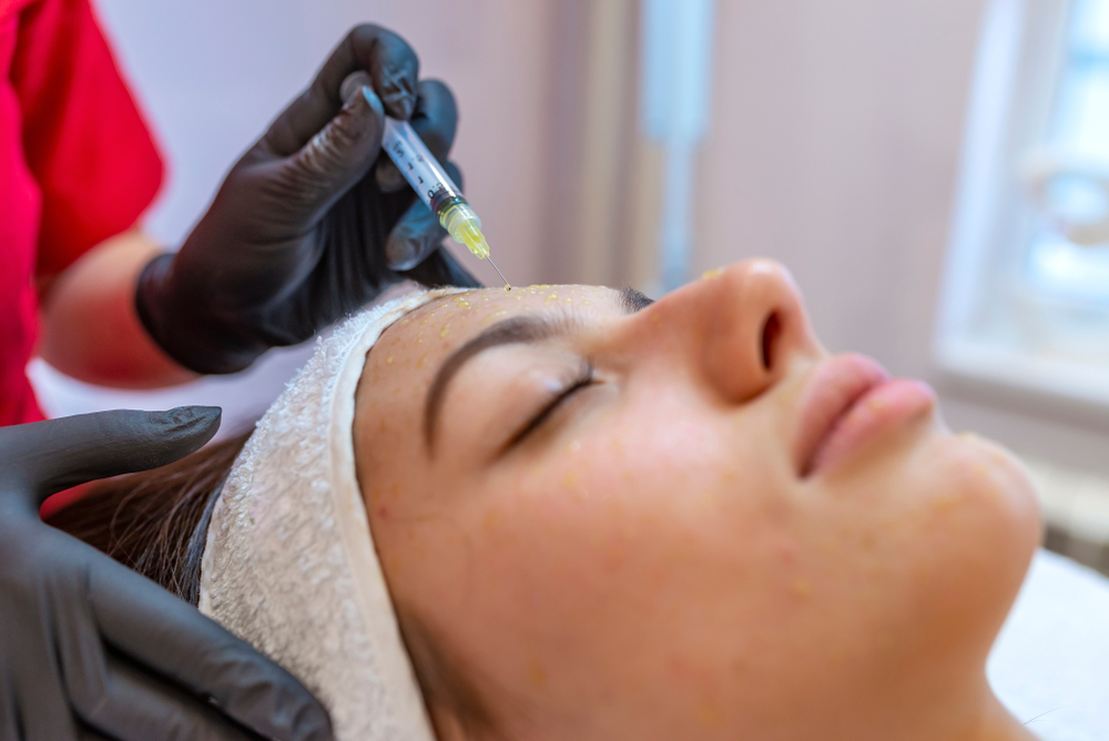 mesotherapy cho khuôn mặt