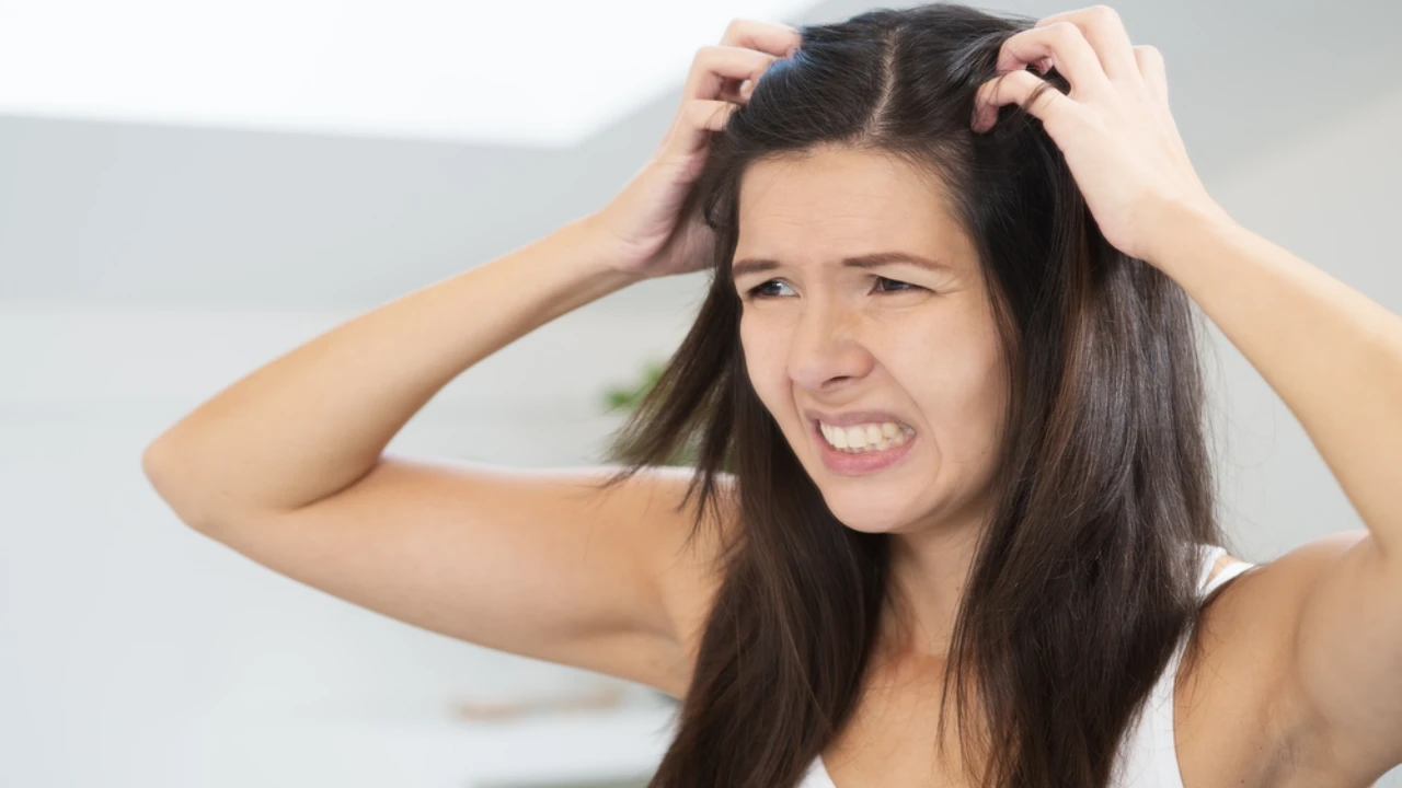 Home Remedies for Itchy Scalp: Say Goodbye to Itchiness