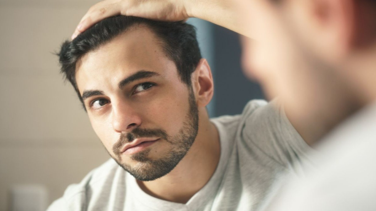 Different Types of Hairlines to Know in Men And Women