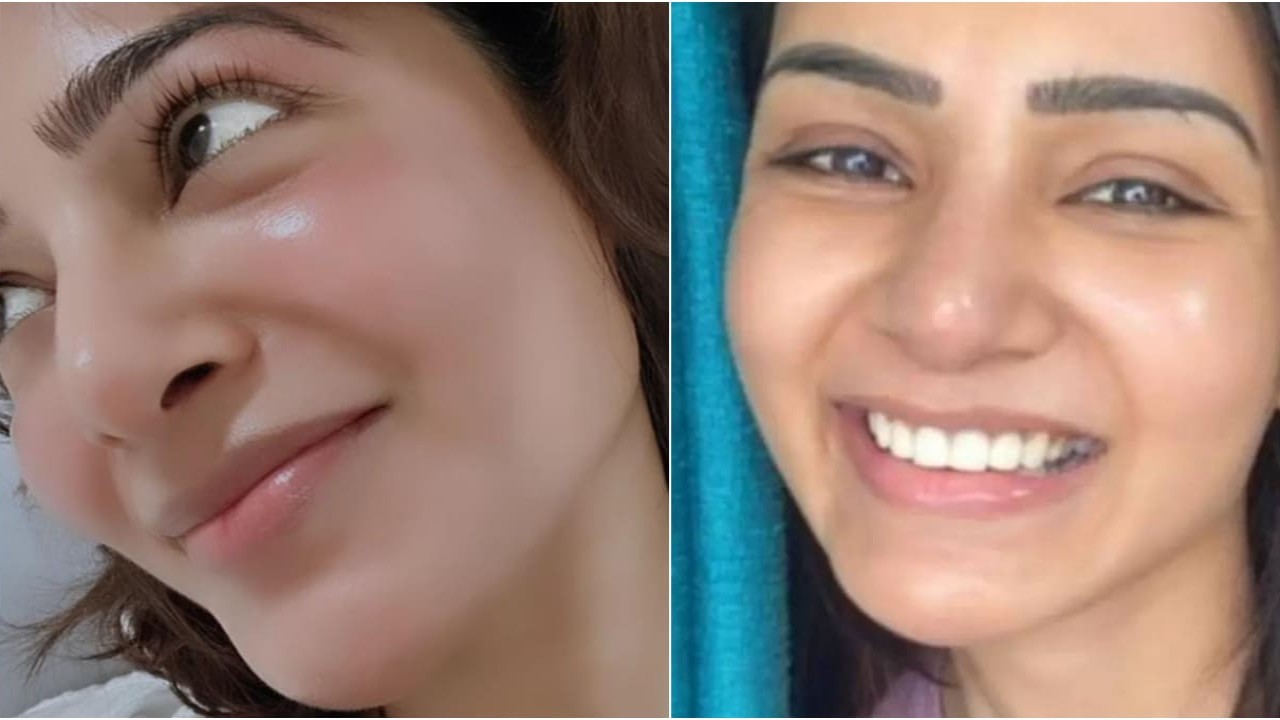 Samantha Ruth Prabhu takes skincare treatment after Bali vacation; Shows off glow in latest pic Samantha Ruth Prabhu Instagram
