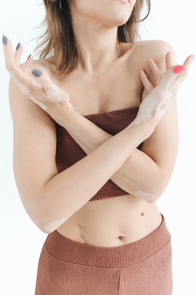 home remedies to treat rashes under breast home remedies to treat rashes under breast