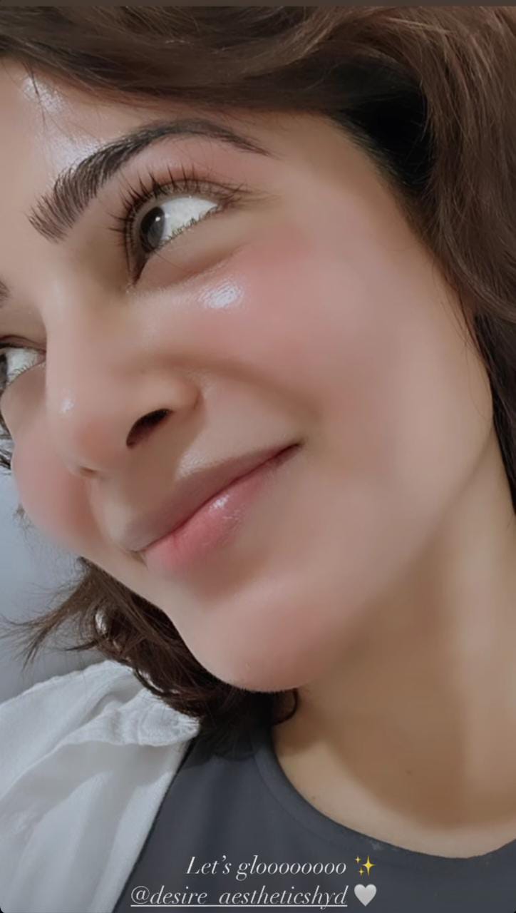 Samantha Ruth Prabhu takes skincare treatment after Bali vacation; Shows off glow in latest pic 