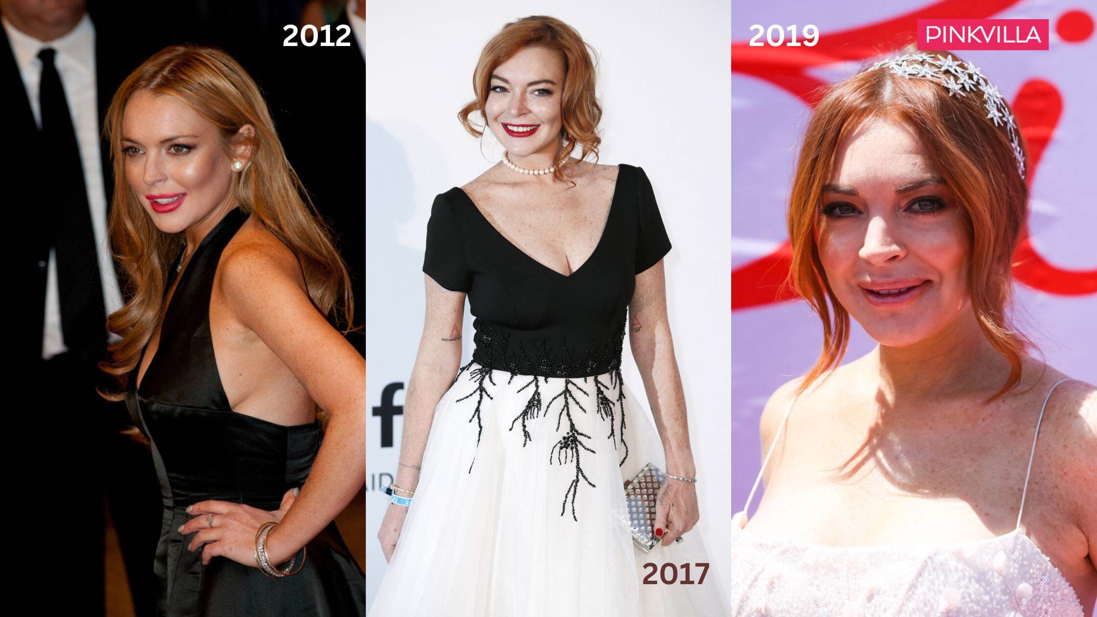 Lindsay Lohan Plastic Surgery Before and After Photos