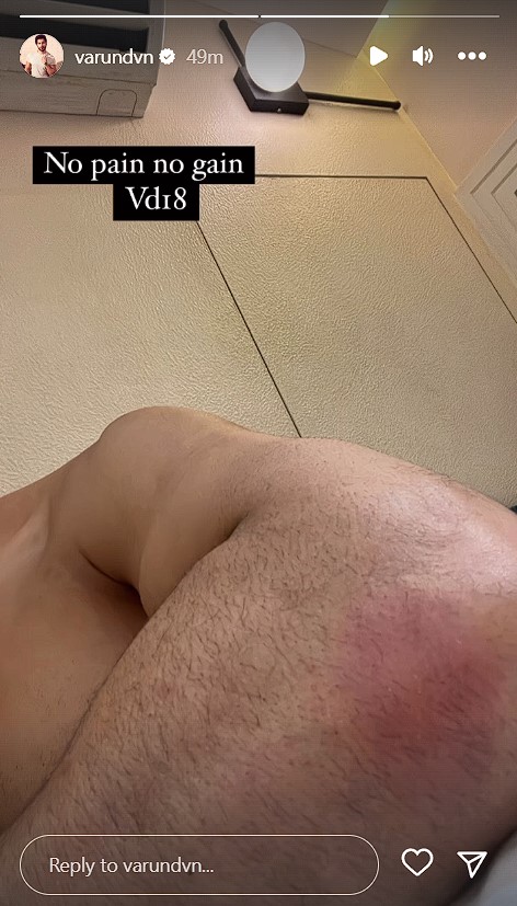 Varun Dhawan Fucking His Girlfriend - Varun Dhawan gets injured a day after he begins filming for Atlee's VD18,  says 'No pain, no gain' | PINKVILLA