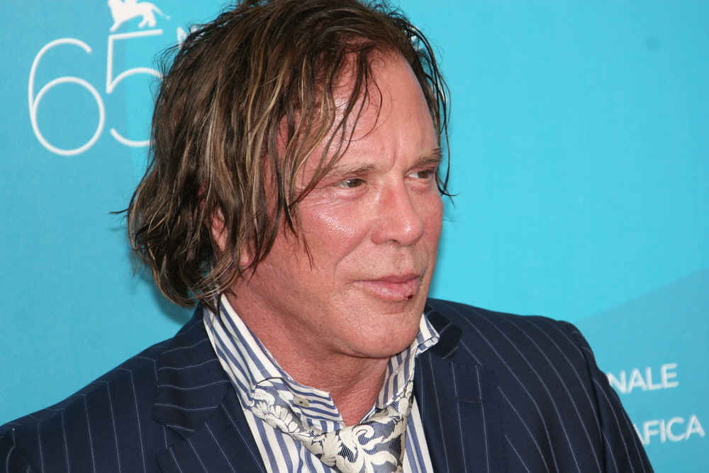 Mickey Rourke’s Plastic Surgery