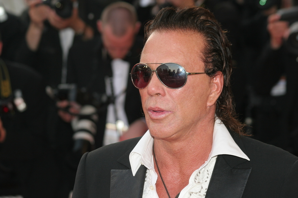 Mickey Rourke’s Plastic Surgery