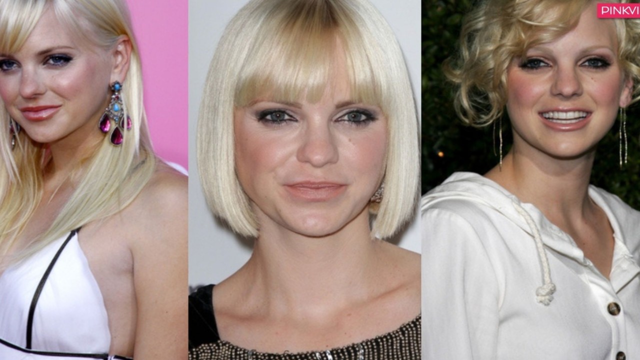 Exploring Anna Faris’s Plastic Surgery Overtime 