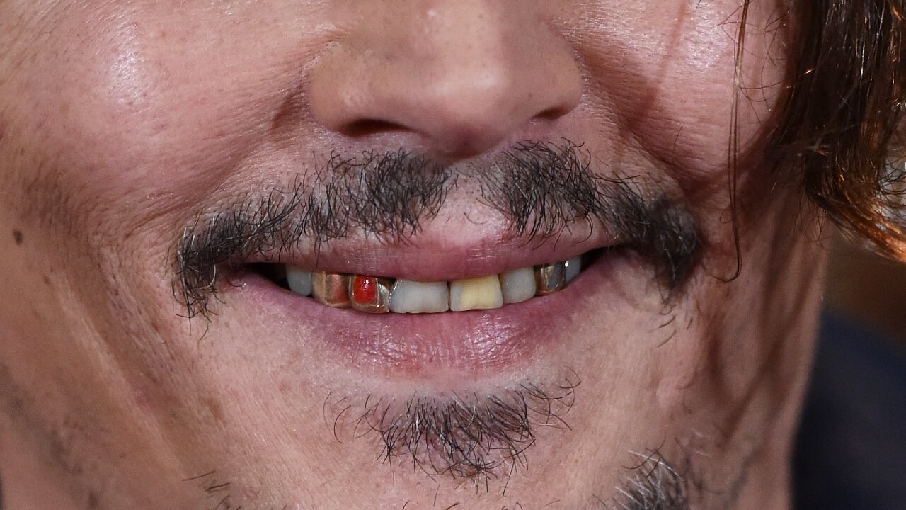 Johnny Depp Teeth (Via Getty Images)
