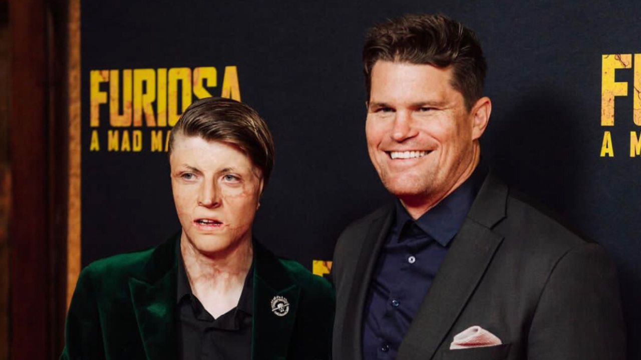 Who Is Spencer Connelly? Meet Tasmanian Teen Who Earned Speaking Role In Furiosa Mad Max Saga
