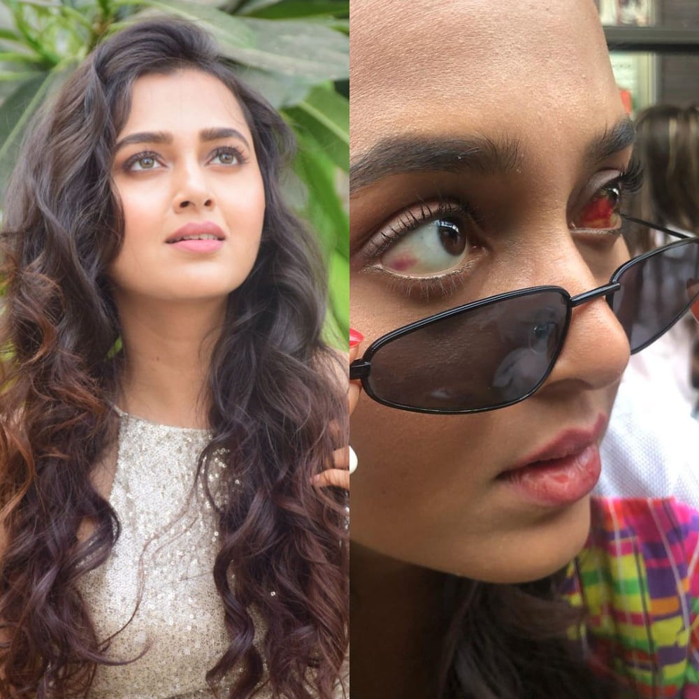 THROWBACK: When Tejasswi Prakash had to leave Khatron Ke Khiladi 10 after horrific eye injury THROWBACK: When Tejasswi Prakash had to leave Khatron Ke Khiladi 10 after horrific eye injury