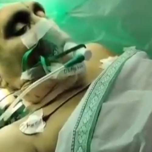Jr NTR's fan watches his film while undergoing brain surgery (PC:Madhu1535 X) 