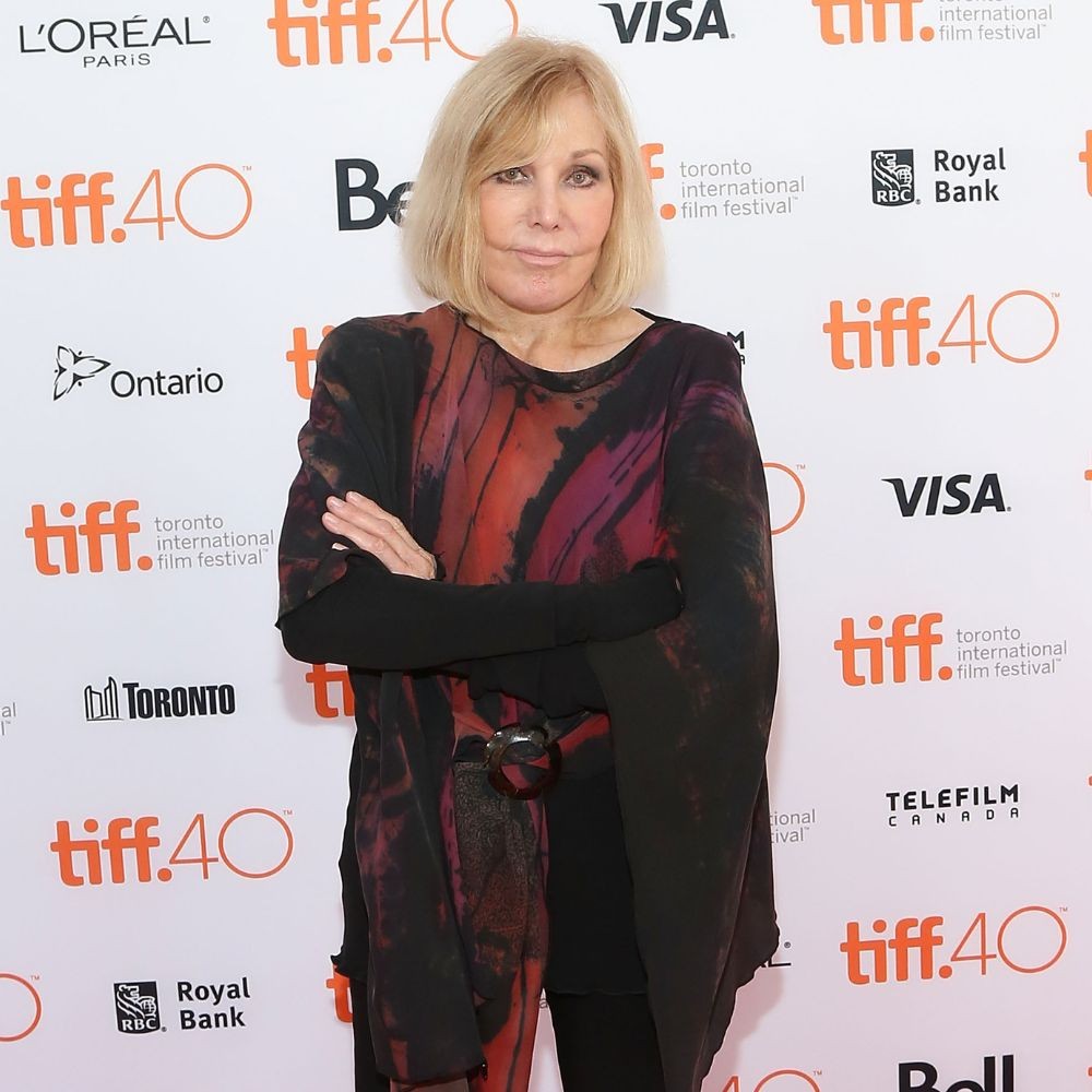 Kim Novak’s Plastic Surgery Transformation: Here’s Everything You Need to Know