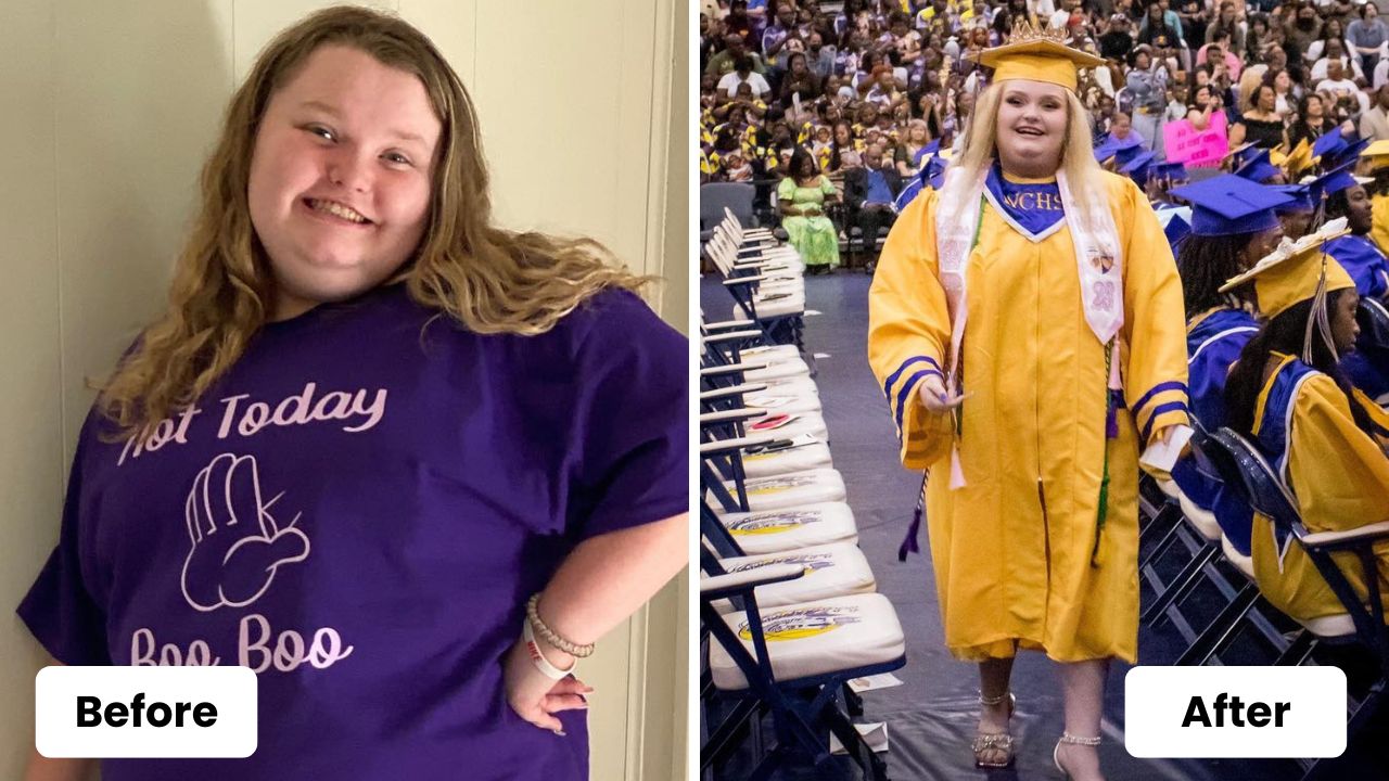 Honey Boo Boo before and after weight loss surgery