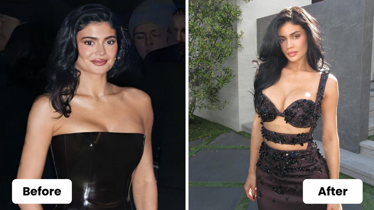 Kylie Jenner before and after weight loss