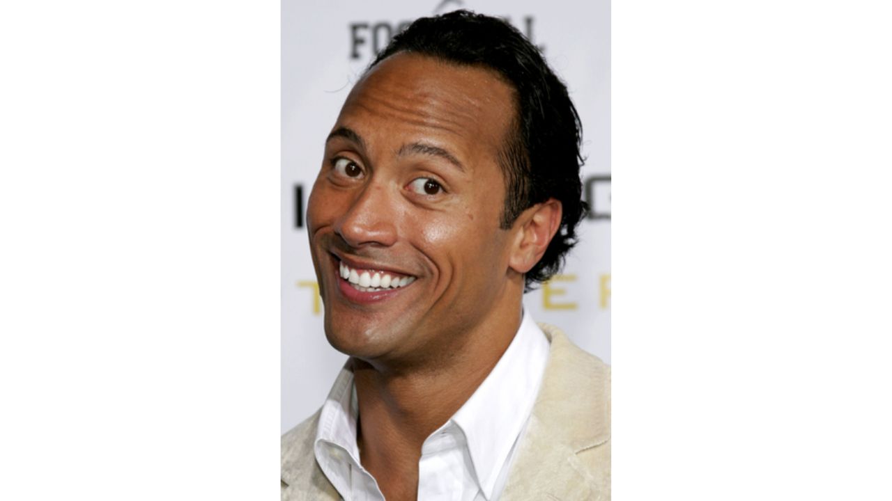 Dwayne Johnson's Plastic Surgery