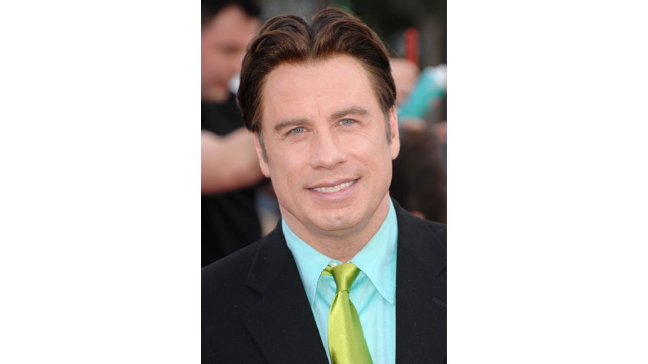 John Travolta’s Plastic Surgery