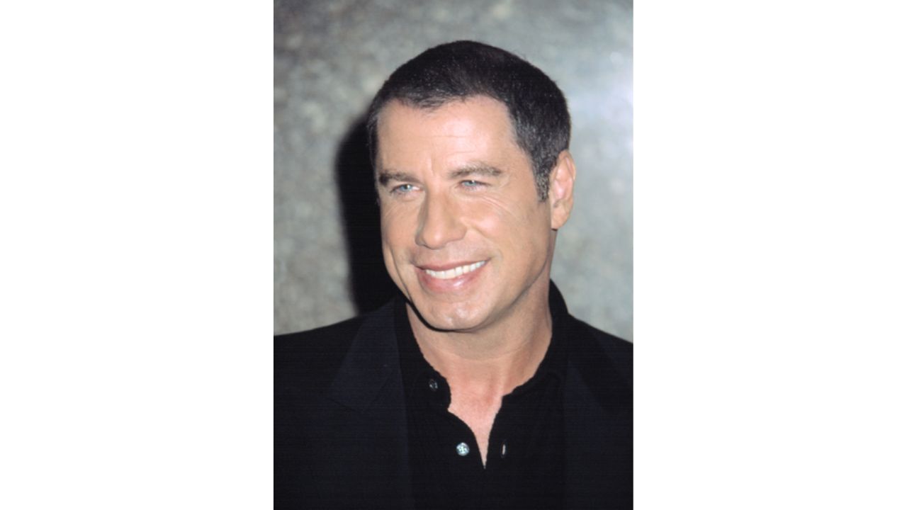 John Travolta’s Plastic Surgery