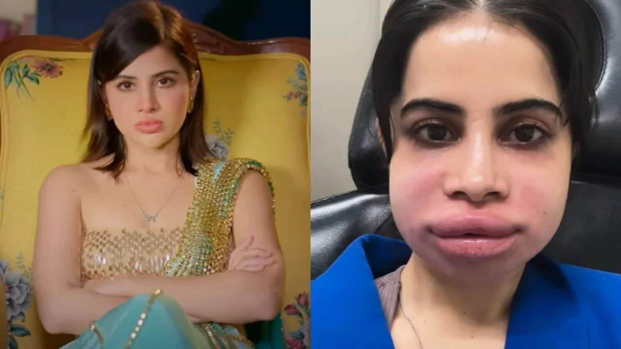Uorfi Javed records herself amid cosmetic surgery (Pic Credit: Prime Video, Uorfi Javed Instagram) Uorfi Javed