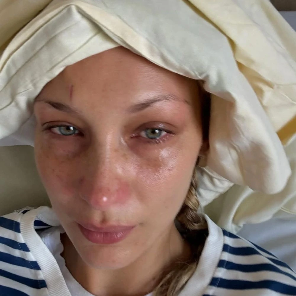 Bella Hadid Shares Photos from Hospital Amid Ongoing Battle with Lyme Disease, Pens a Note