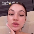 Bhad Bhabie reveals transformation after removing 'all' fillers; Deets here 