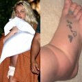 Britney Spears Gives Update On Her Swollen Foot After Chateau Marmont Incident; Says It's 'Already Better'