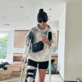‘Life Looks A Lil Different Lately’: Nina Dobrev Updates Her Fans After Major Injury Following Bike Accident