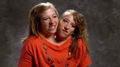 ‘Yeah, We're Going To Be Moms’: Looking Back At Conjoined Twins Abby And Brittany Hansel's Motherhood Plans Amid Reports Of Abby's Marriage
