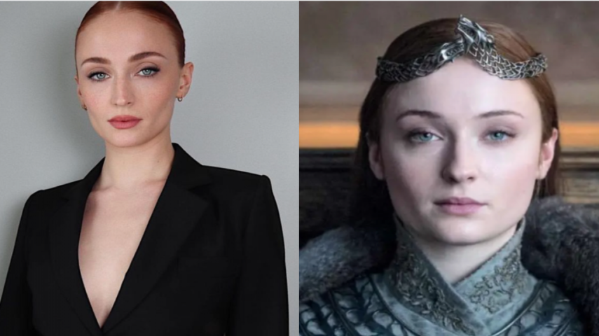 Sophie Turner opt for buccal fat removal? Lets find out (Pc credit - Instagram/ YouTube)